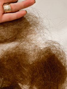 Hair loss after Covid